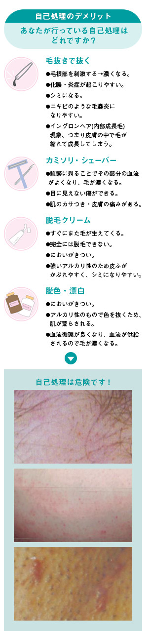 自己処理のデメリット あなたが行っている自己処理はどれですか？